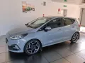 Ford Fiesta 5 Porte 1.5 ST s&s 200cv CON PERFORM